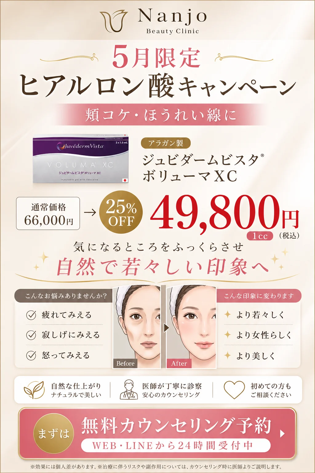 5月限定 ヒアルロン酸キャンペーン｜アラガン製ジュビダームビスタ ボリューマXC 1cc 通常66,000円→25%OFF 49,800円（税込）