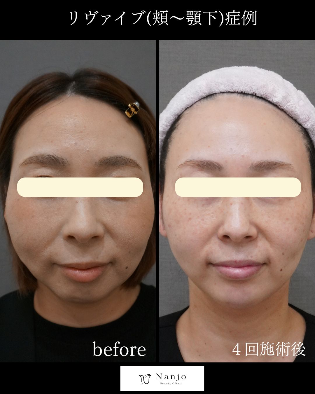 当院の症例写真